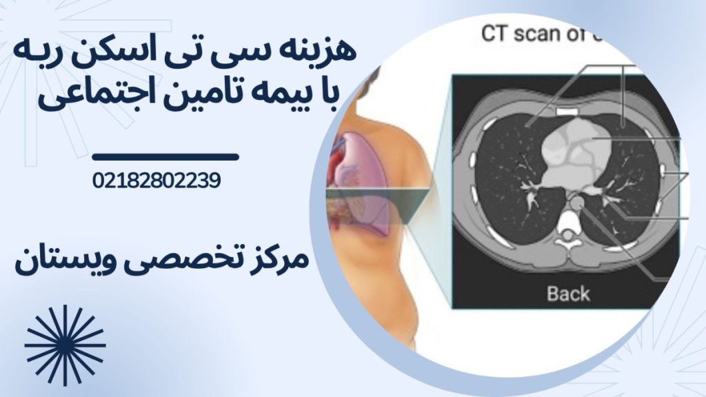 اسکن ریه - نوشته : هزینه سی تی اسکن ریه با بیمه تامین اجتماعی