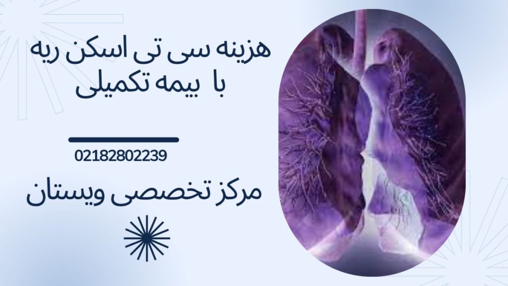 تصویر دیجیتالی از اسکن ریه