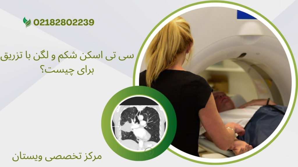 یک خانم در حال انجام سی تی اسکن شکم و لگن با تزریق