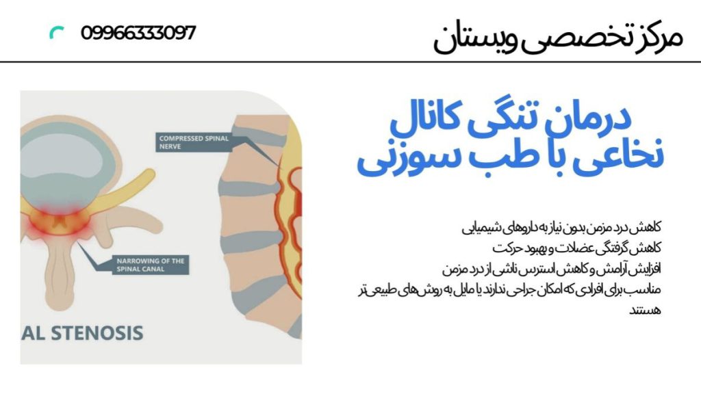 ستون فقرات و کانال نخاعی انسان
