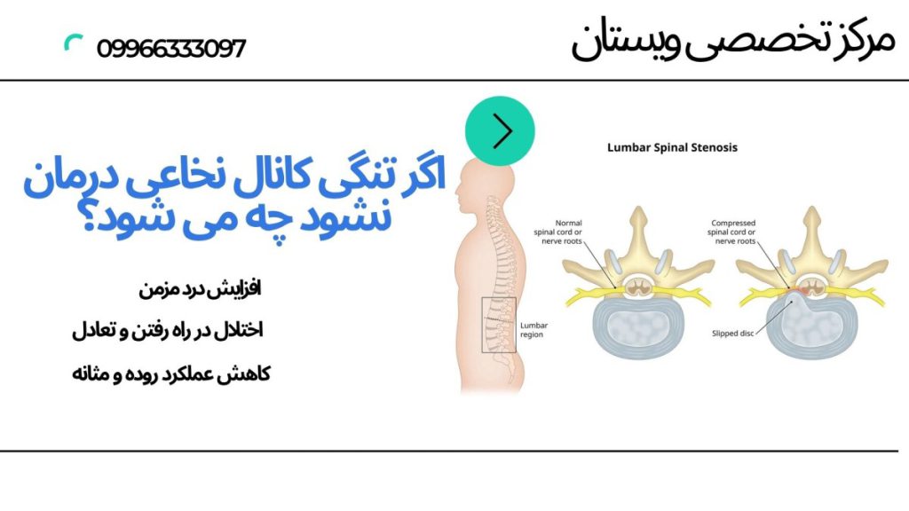 مهره های ستون فقرات و نخاع در داخل آنها
