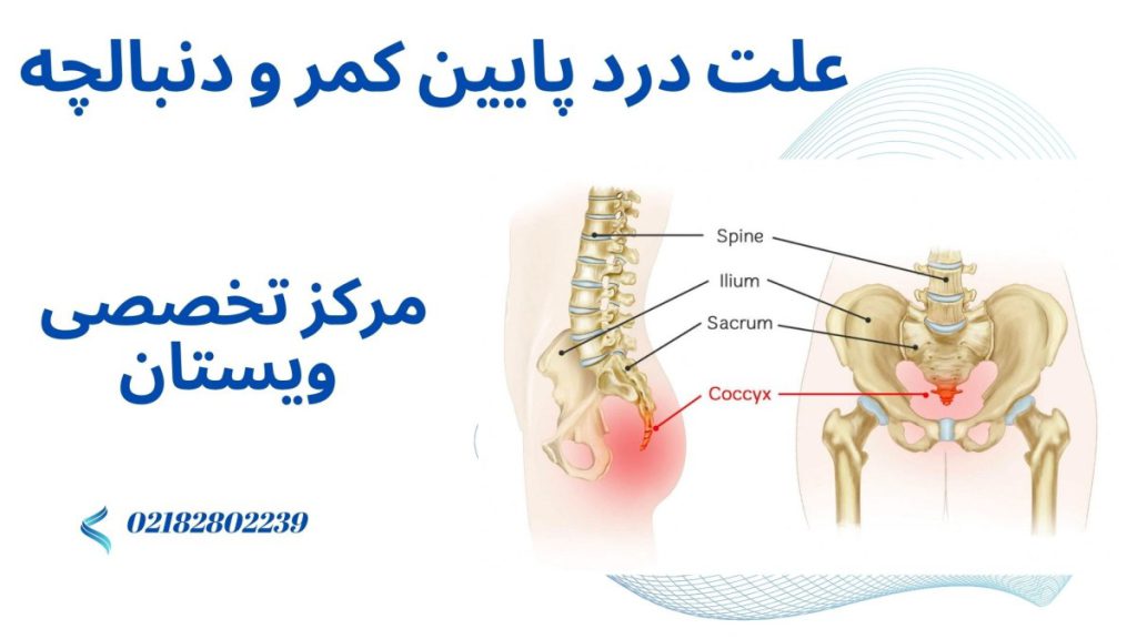 علت درد پایین کمر استخوان ستون فقرات و استخوتن لگن و دنبالچه