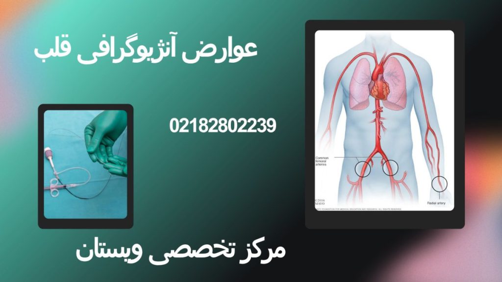 دو تضصویر از انجام آنژیوگرافی قلب