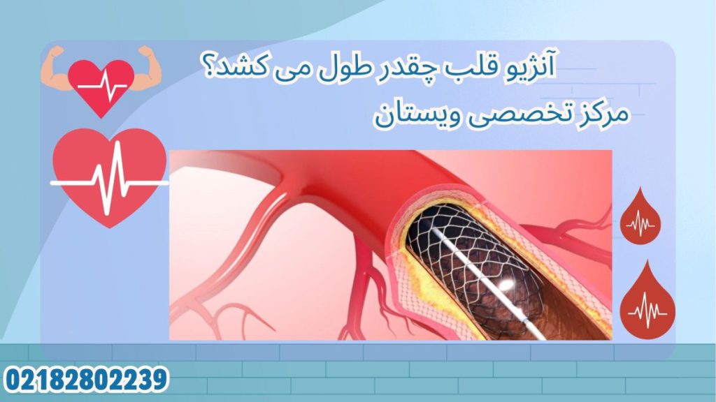 مدت زمان آنژیوگرافی یک رگ قلب و باز کردن ان بوسیله آنژیو گرافی