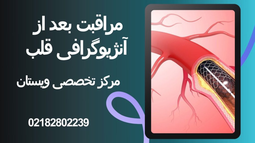 تصویر آموزشی از آنژیو قلب-نوشته : مراقبت بعد از آنژیوگرافی قلب 