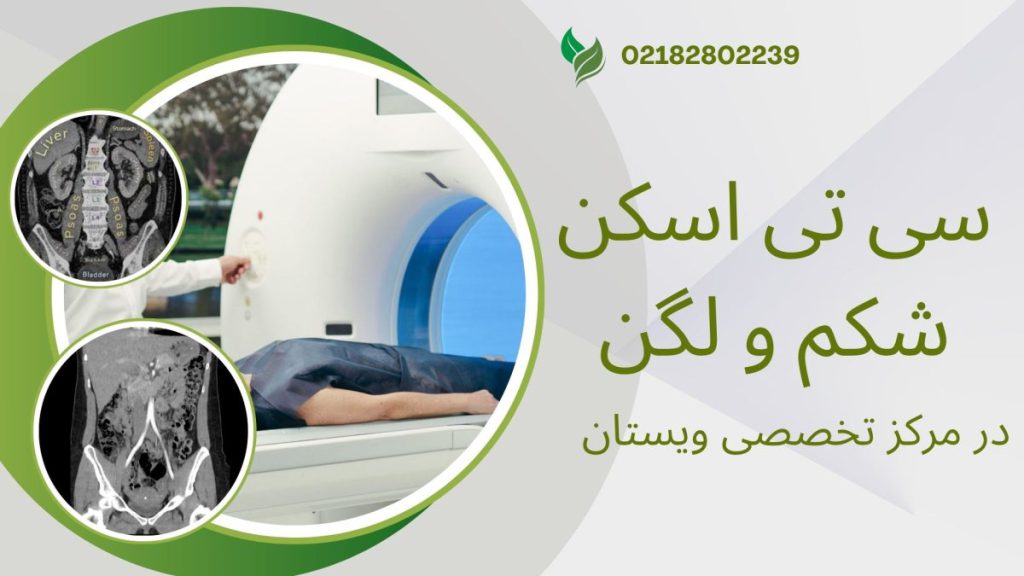 مرکز سی تی اسکن شکم و لگن ویستان