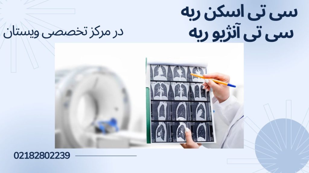 مرکز سی تی اسکن ویستان