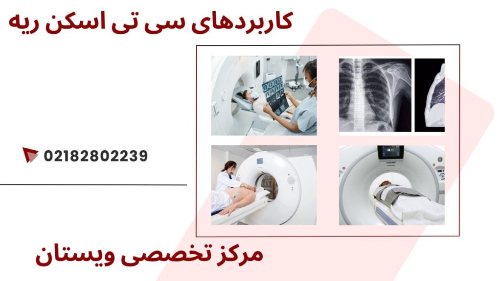کاربرد سی تی اسکن ریه چهار تصویر از سی تی اسکن ریه