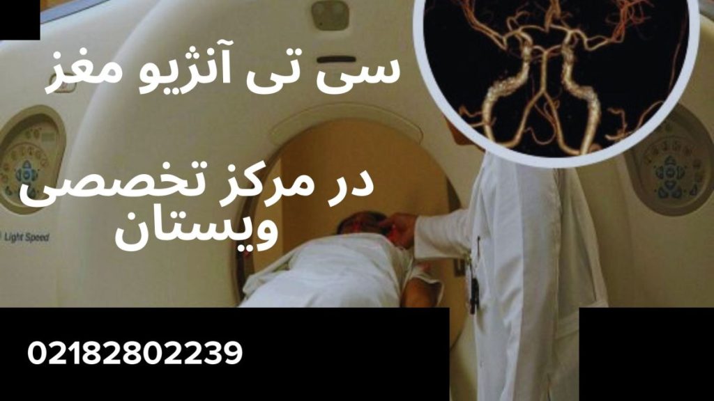 مرکز سی تی آنژیو مغز ویستان