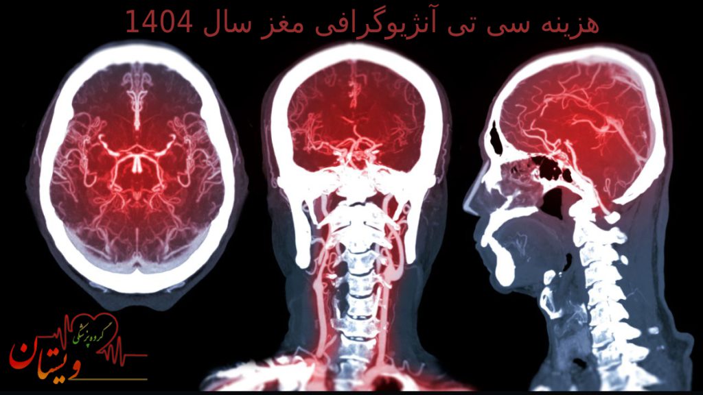 تصویری از جواب سی تی اسکن مغز با نقاط قرمز و سفید و مشکی 