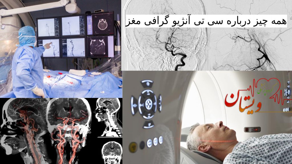 تصاویری مربوط به سی تی انژیو مغز بیمار در دستگاه اسکن و تفسیر توسط پزشک