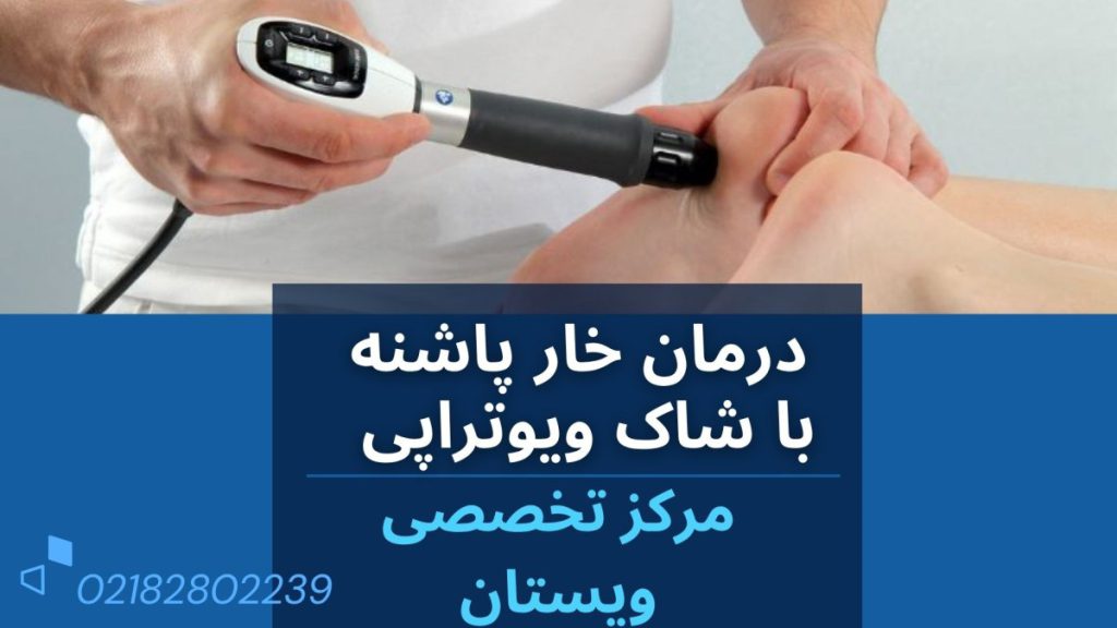 پزشک در حال درمان خار پاشنه با شاک ویو تراپی
