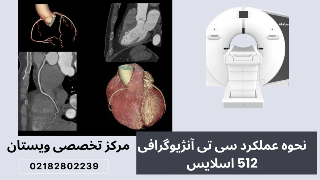 دو تصویر از دستگاه سی‌ تی آنژیوگرافی 512 اسلایس و نتیجه بعد از انجا آن