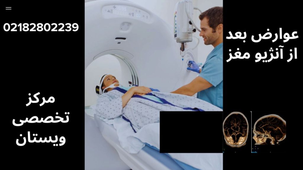 پزشک در کنار بیمار در حال انجام آنژیوگرافی مغز