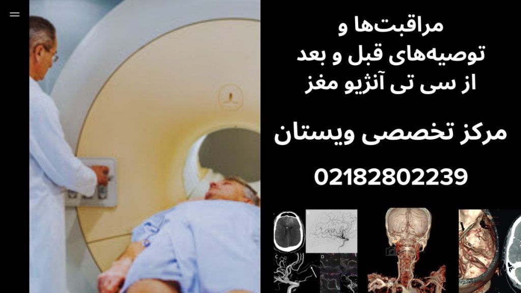 یک تصویر بزرگ و سه تصویر کوچک از آنژیوگرافی مغز