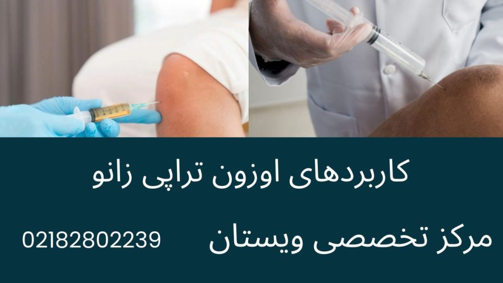 دو تصویر از تزریق اوزون به زانو