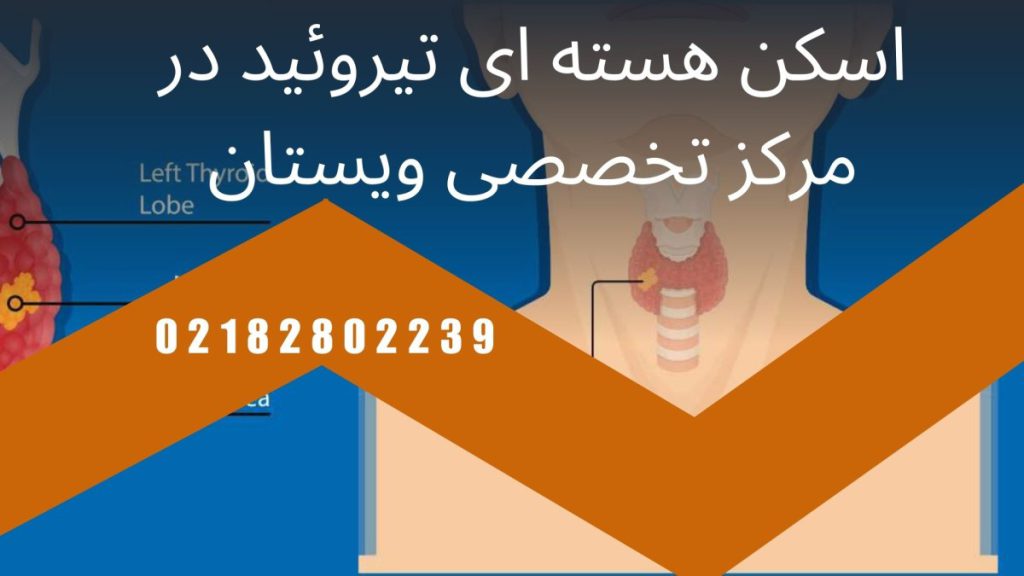 اسکن تیروئید در مرکز ویستان
