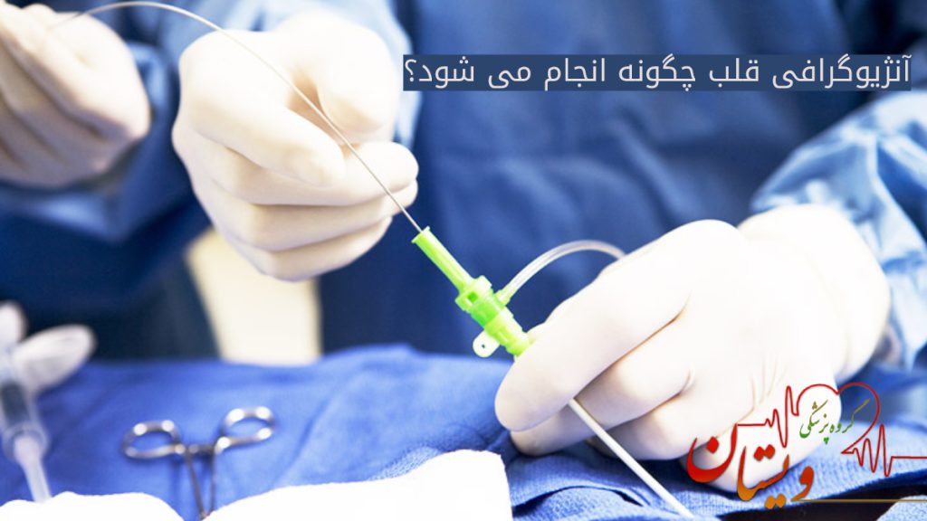 نحوه انجام آنژیوگرافی قلب - پزشک متخصص قلب در حال وارد کردن کاتتر به شریان جهت آنژیوگرافی