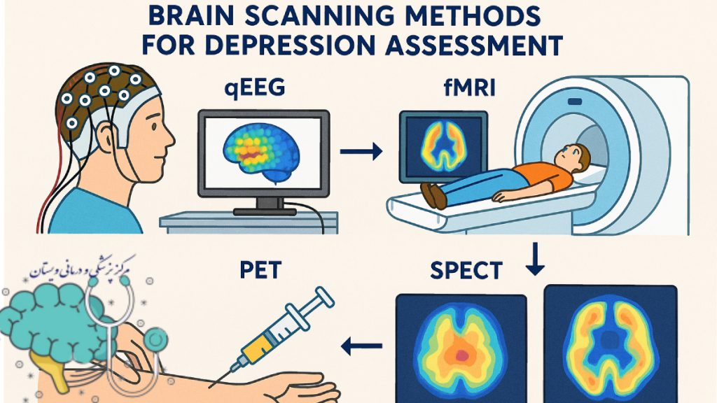 تصویری شماتیک از انواع روش های qEEG، fMRI، PET، SPECT برای تشخیص افسردگی