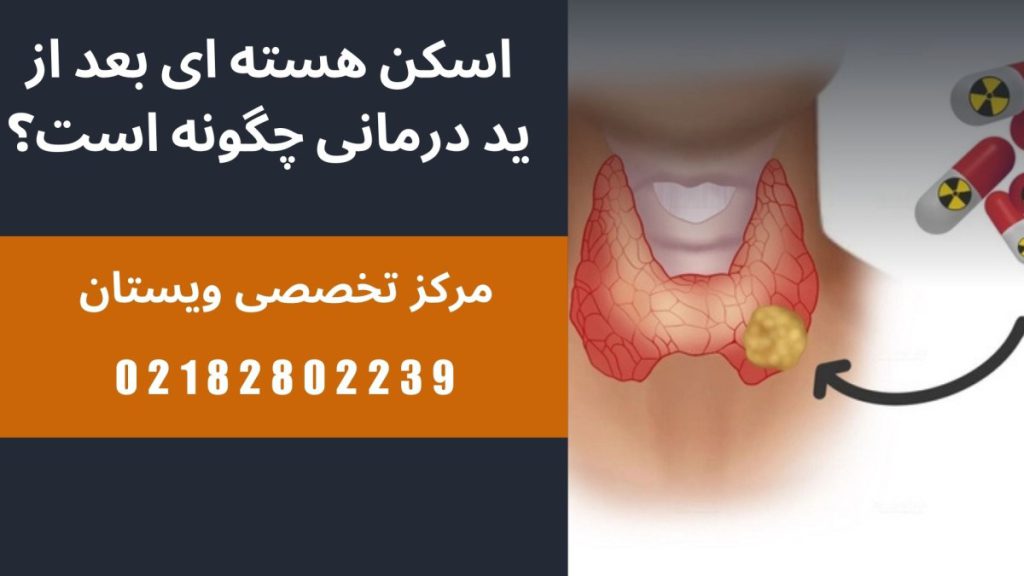 تصویر انیمیشنی از اسکن هسته ای بعد از ید درمانی