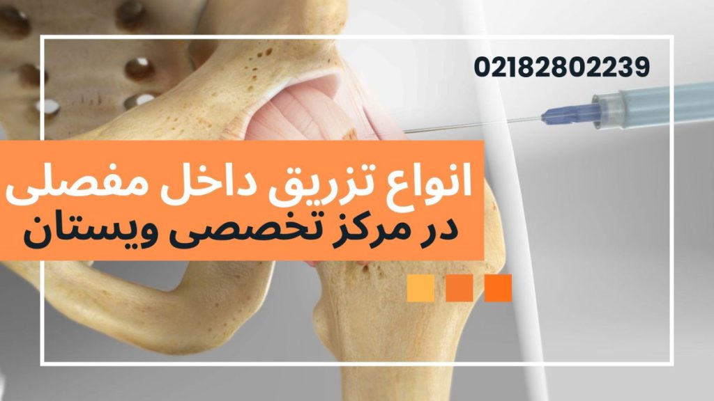تزریق داخل مفصلی در ویستان