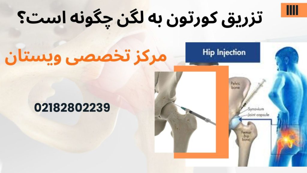 دو تصویر از تزریق کورتون به لگن بیمار