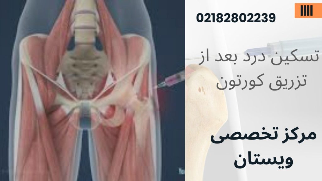 تصویر آموزشی از لگن انسان