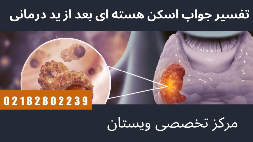 اسکن هسته ای تیروئید در تصویر آموزشی