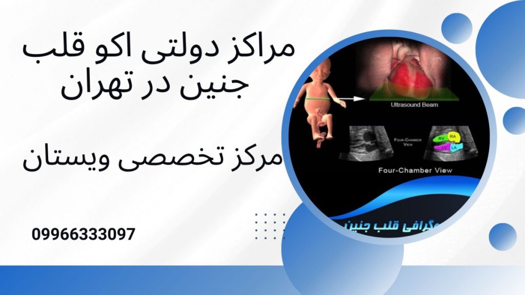مراکز دولتی اکو قلب جنین در تهران 