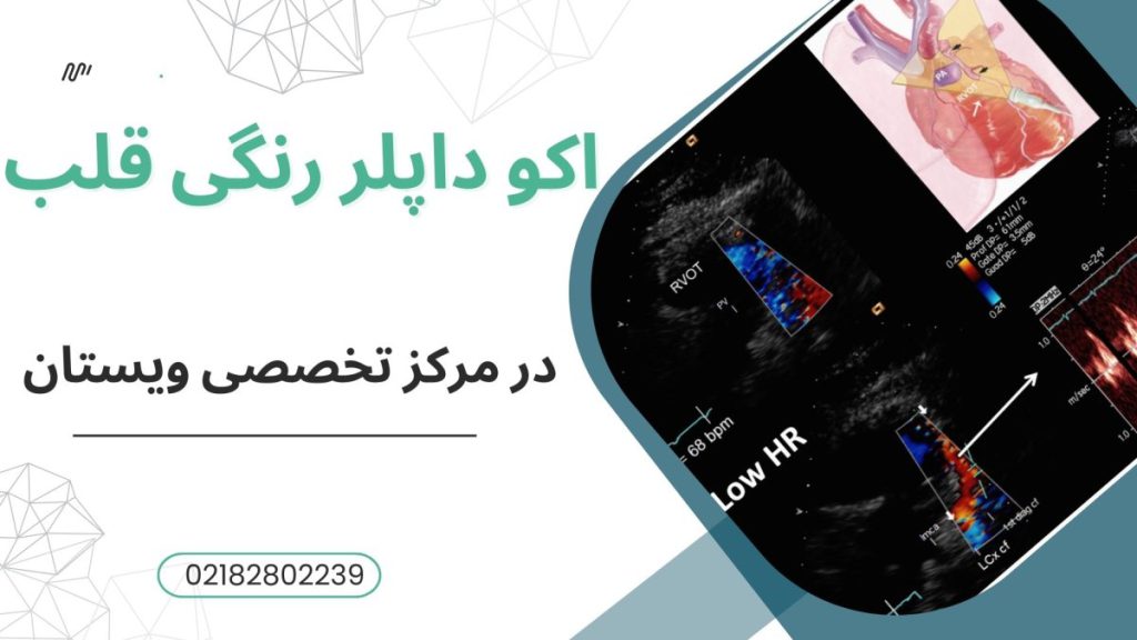 مرکز اکو داپلر ویستان