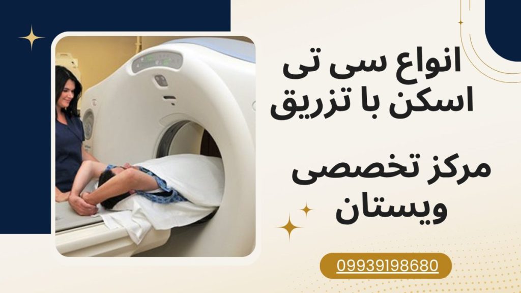 انواع سی تی اسکن با تزریق