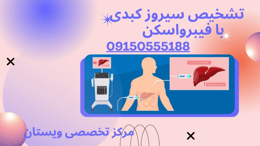 تشخیص سیروز کبدی تشخیص سیروز کبدی با فیبرواسکن