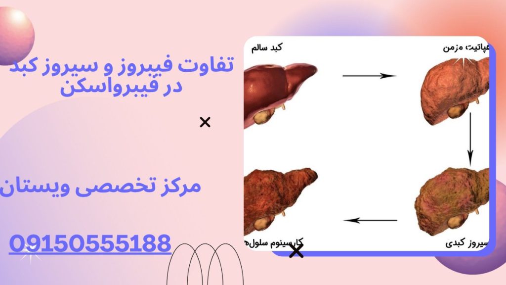 تفاوت فیبروز و سیروز کبد تفاوت فیبروز و سیروز کبد در فیبرواسکن