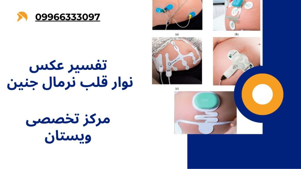 تفسیر عکس نوار قلب نرمال جنین