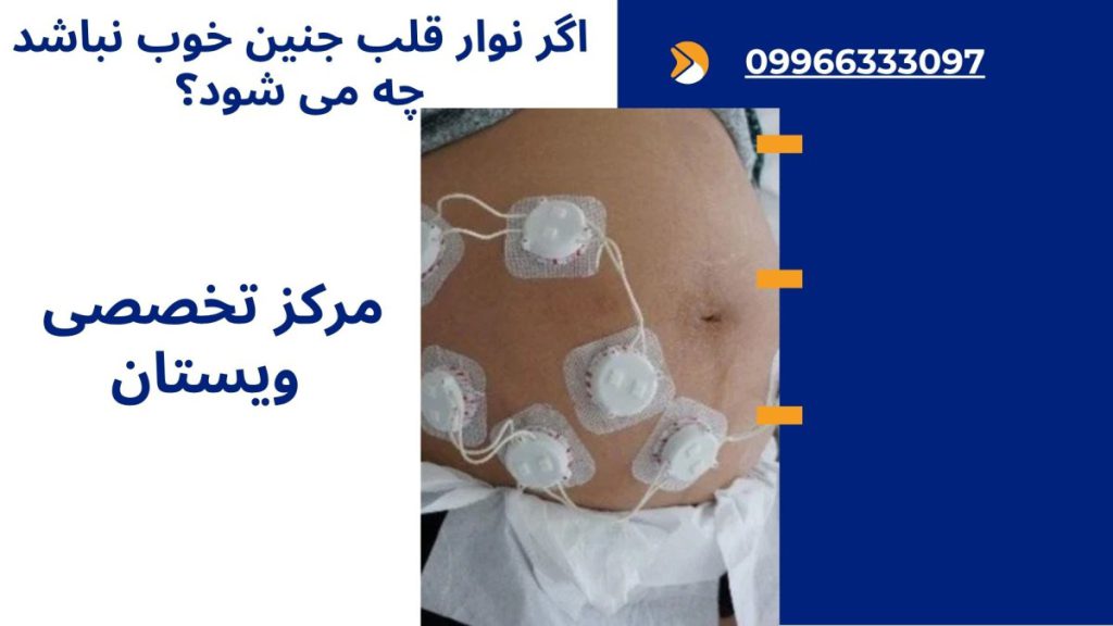 اگر نوار قلب جنین خوب نباشد چه می شود؟