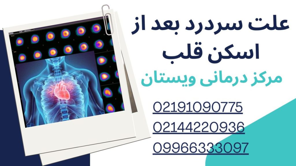 علت سردرد بعد از اسکن هسته ای علت سردرد بعد از اسکن قلب