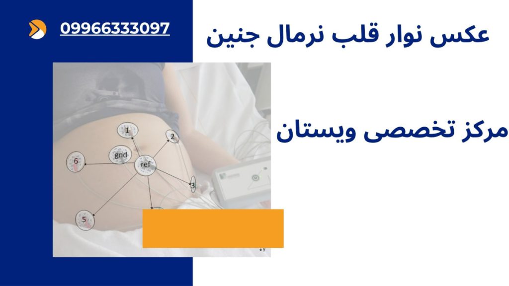 عکس نوار قلب نرمال جنین 