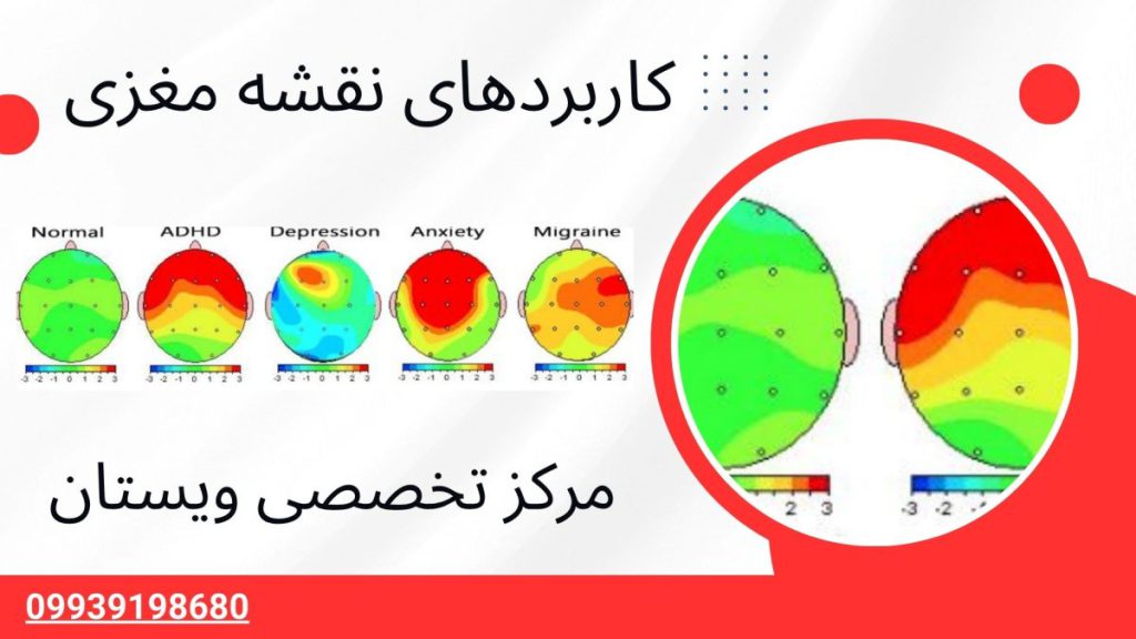 نقشه مغزی چه کاربردهایی دارد چند تصویر از کاربردهای نقشه مغزی