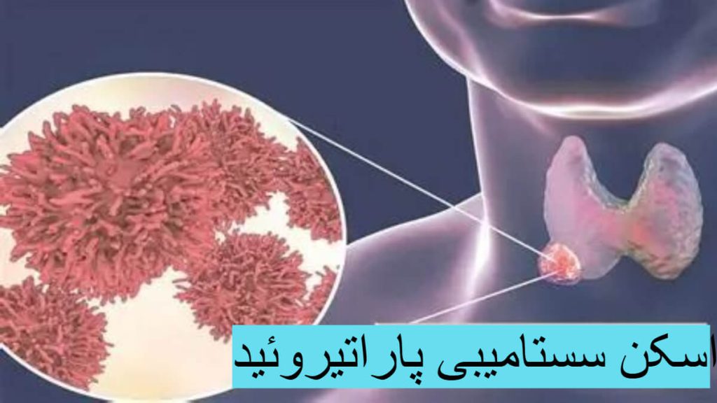 اسکن سستامیبی پاراتیروئید اسکن سستامیبی پاراتیروئید