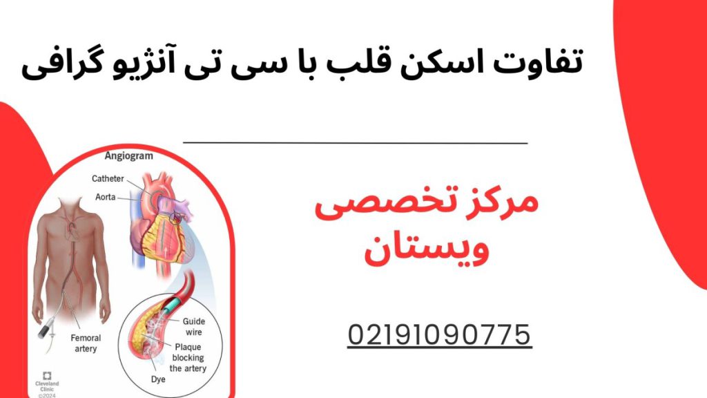 تفاوت اسکن قلب با سی تی آنژیو تفاوت اسکن قلب با سی تی آنژیو گرافی قلب