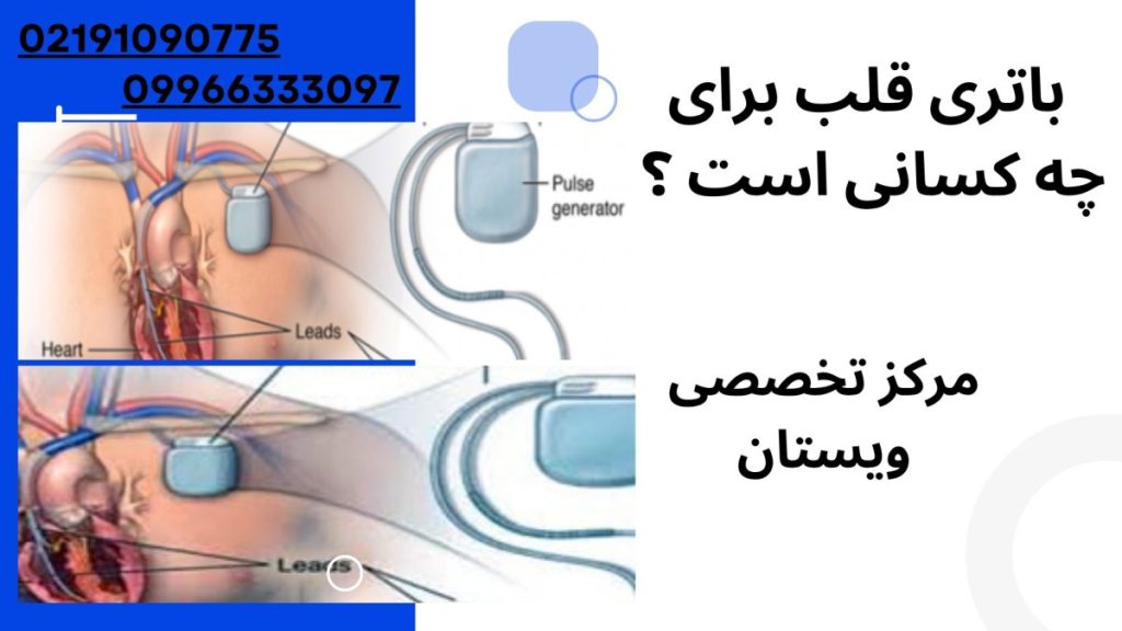 باتری قلب برای چه کسانی است ؟ 
