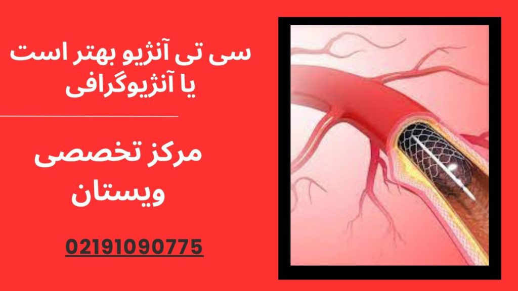 سی تی آنژیو بهتر است یا آنژیوگرافی
