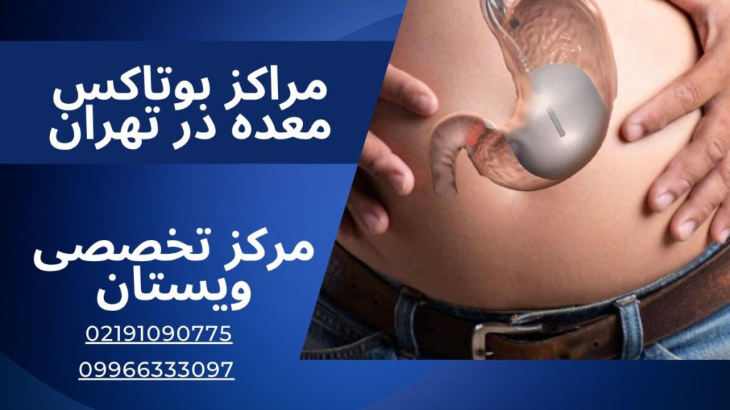 مراکز بوتاکس معده در تهران