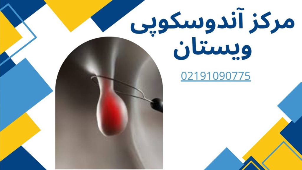 مرکز آندوسکوپی ویستان