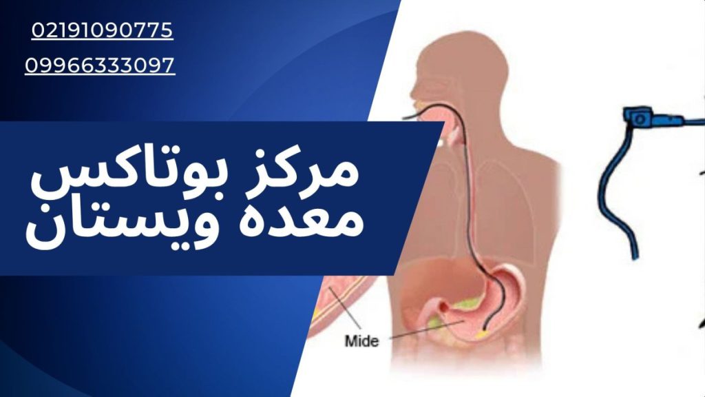 مرکز بوتاکس معده ویستان