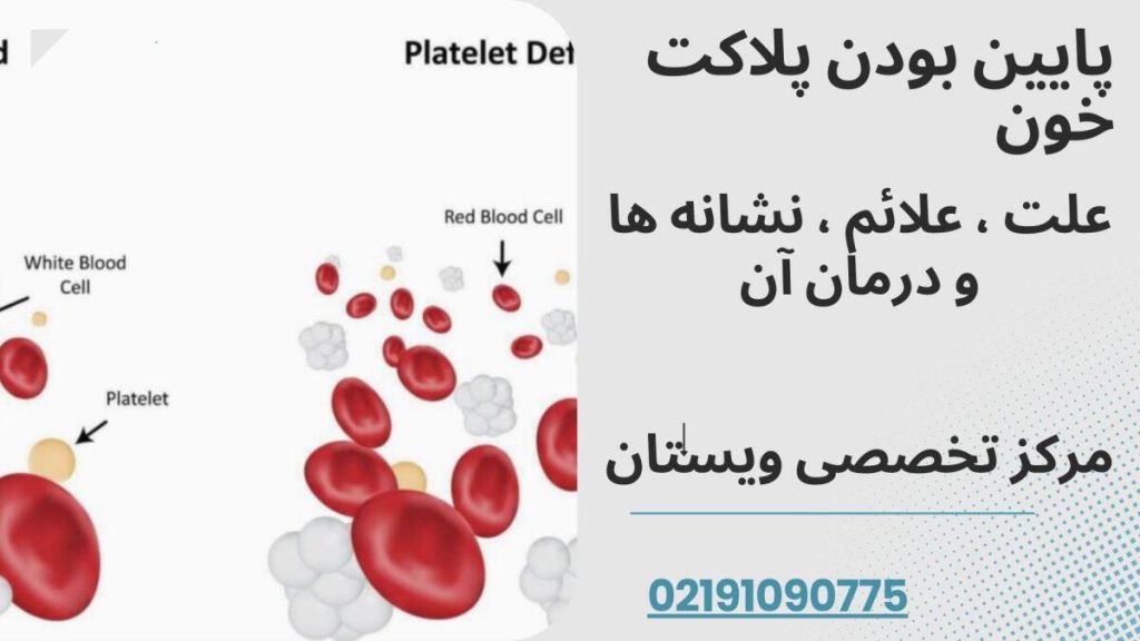 درمان پایین بودن پلاکت خون در ویستان