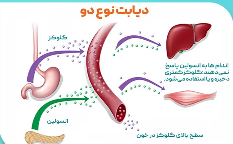 چه کسانی بیشتر در معرض دیابت نوع ۲ هستند؟ چه کسانی بیشتر در معرض دیابت نوع ۲ هستند؟