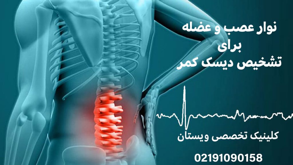 نوار عصب و عضله در تشخیص دیسک کمر و نحوه انجام آن
