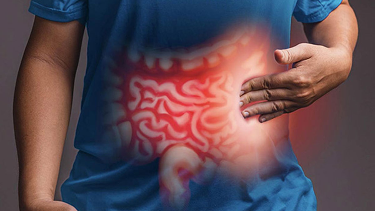 التهاب روده (IBD) چیست؟ التهاب روده و سندرم روده تحریکپذیر چیست؟ تفاوتها و علائم