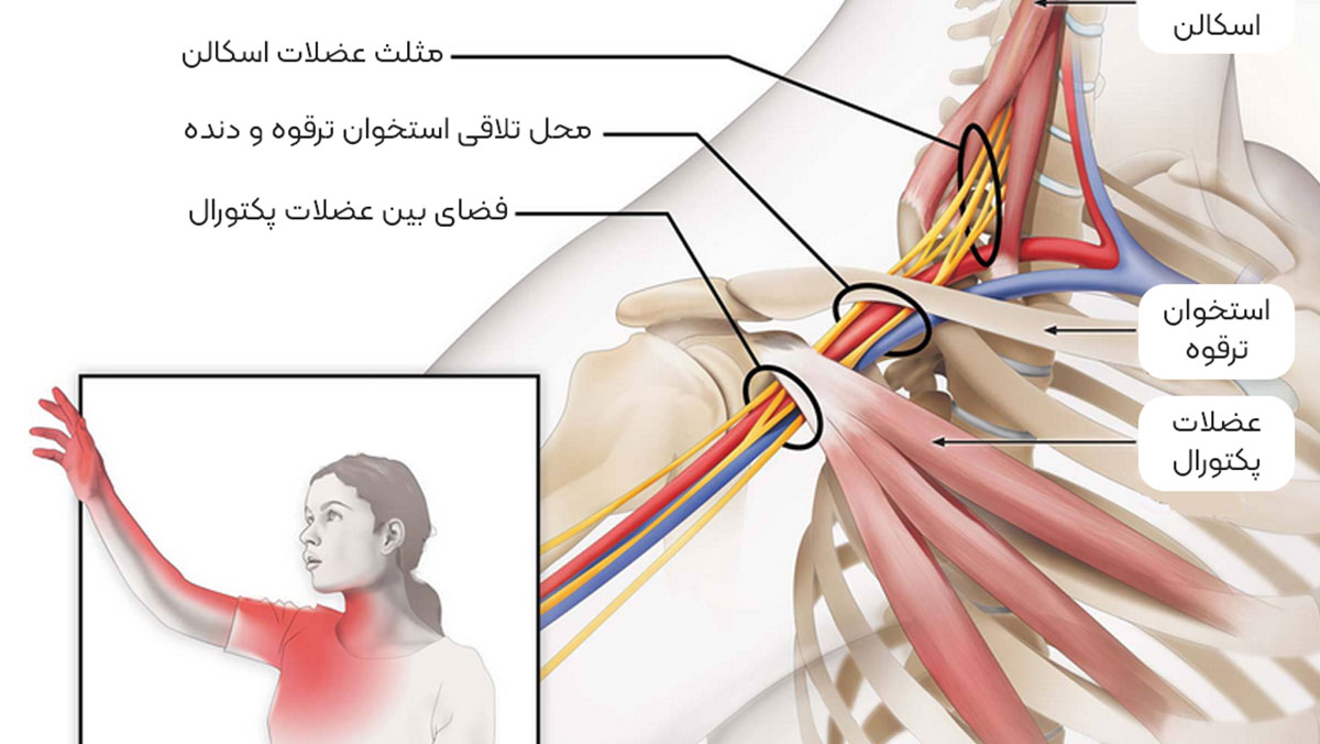نوار عصب دست و گردن چه تفاوتی دارد؟ نوار عصب دست و گردن چه تفاوتی دارد؟ + تصویری از عضلات و عصب های گردن یک فرد